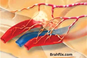 Teoria Electrolitica de Migraña